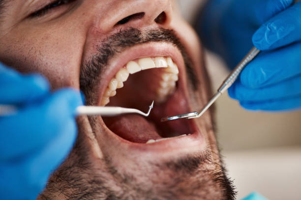 Best Emergency Cosmetic Dentistry (e.g., broken veneers) in Chickasha, OK
